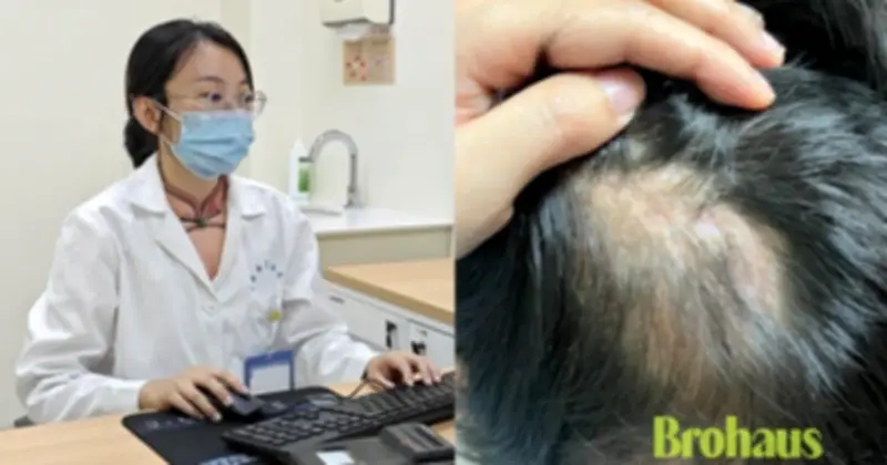Bé gái 5 tuổi ôm thỏ bị hói vĩnh viễn do nấm da