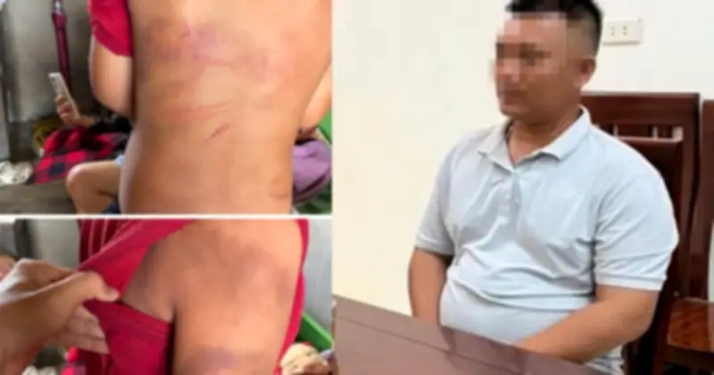 Bé trai 10 tuổi bị bố đẻ bạo hành: Lời khai gây sốc tại công an