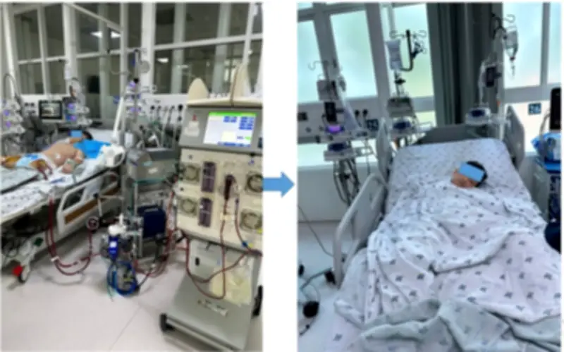 Bé trai 11 tuổi viêm cơ tim nguy kịch vì sai lầm của cha mẹ khi con sốt nhẹ