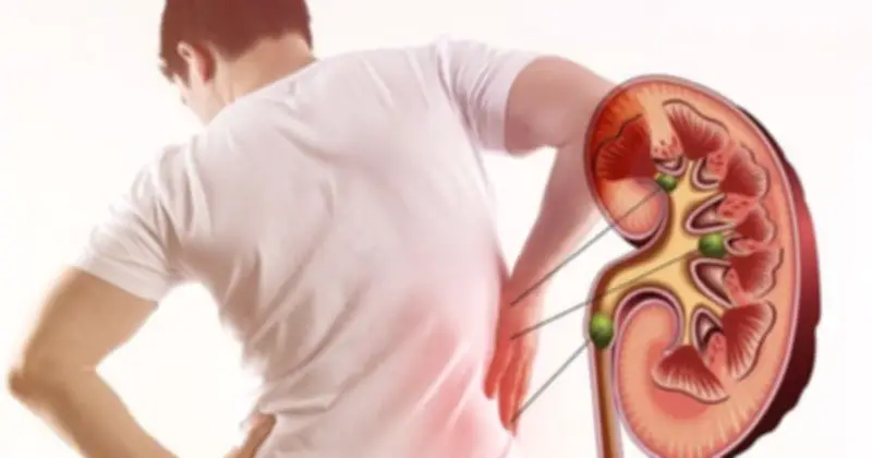 Bác sĩ cảnh báo: 5 dấu hiệu suy thận dễ nhầm với đau lưng thông thường