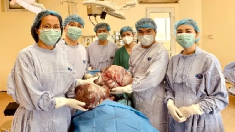 Cô gái 16 tuổi mang khối u buồng trứng nặng gần 15kg
