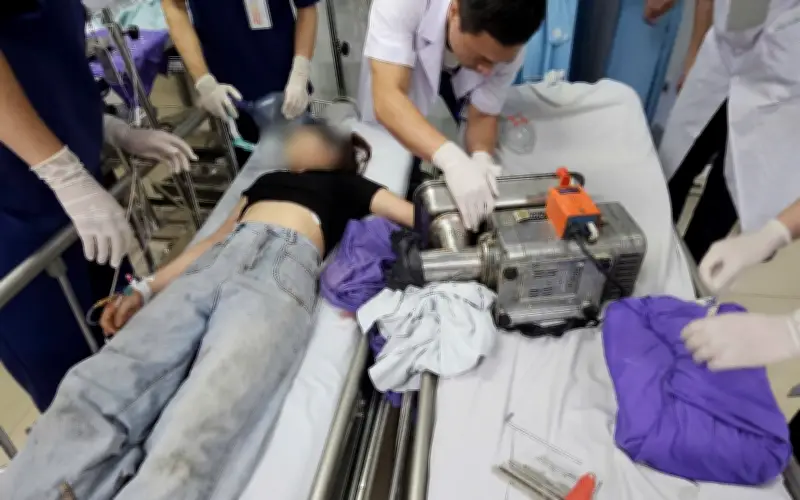 Cô gái 19 tuổi nguy cơ mất bàn tay vĩnh viễn vì sơ suất khi dùng máy xay