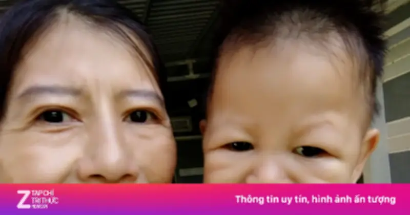 Cô gái mang gương mặt bà cụ vì lão hóa sớm, giờ ra sao?