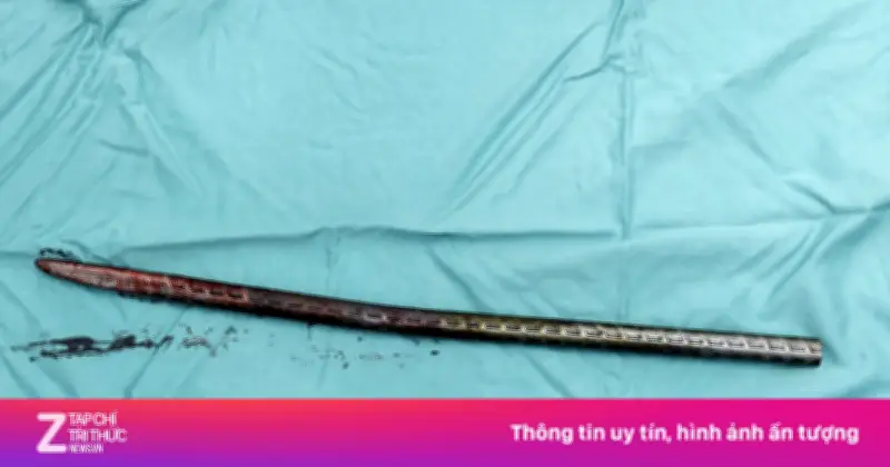 Ca mổ kịch tính: Rút xà beng 1,5m xuyên đùi bệnh nhân