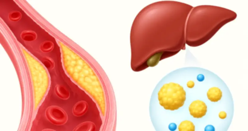 Cholesterol là gì? Phân biệt cholesterol tốt và xấu, cách kiểm soát hiệu quả