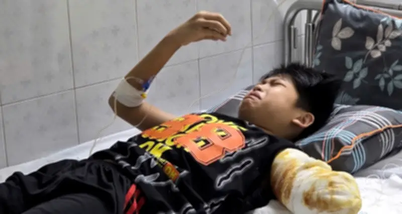 Cậu bé 11 tuổi bị điện giật, mẹ ơi tay con đau rồi