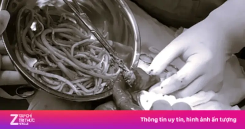 Dấu hiệu cảnh báo người lớn cần xổ giun sán kịp thời