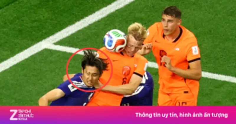 Hiroki Ito và căn bệnh bạch biến giống Michael Jackson tại World Cup 2026