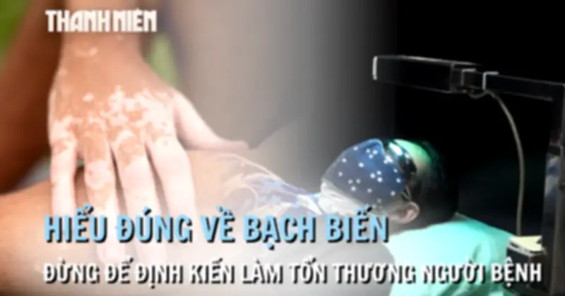 Hiểu đúng về bạch biến: Đừng để định kiến làm tổn thương người bệnh