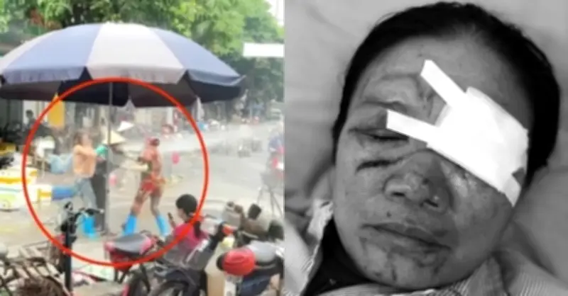 Liên tiếp xảy ra xịt vòi nước cao áp vào người khác: Luật sư nói gì?