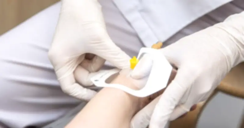 Liệu pháp miễn dịch chu phẫu tăng gấp đôi tỷ lệ đáp ứng ung thư bàng quang