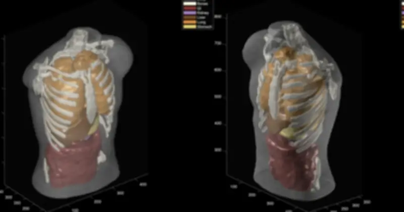 Midjourney ra mắt máy quét siêu âm toàn thân, nhanh hơn MRI gần 100 lần
