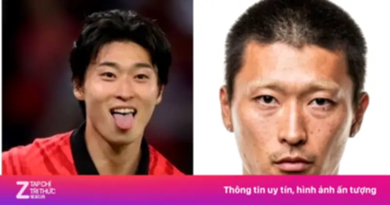 'Nam thần' World Cup 2022 Cho Gue-sung gây bất ngờ với diện mạo khác lạ sau chấn thương