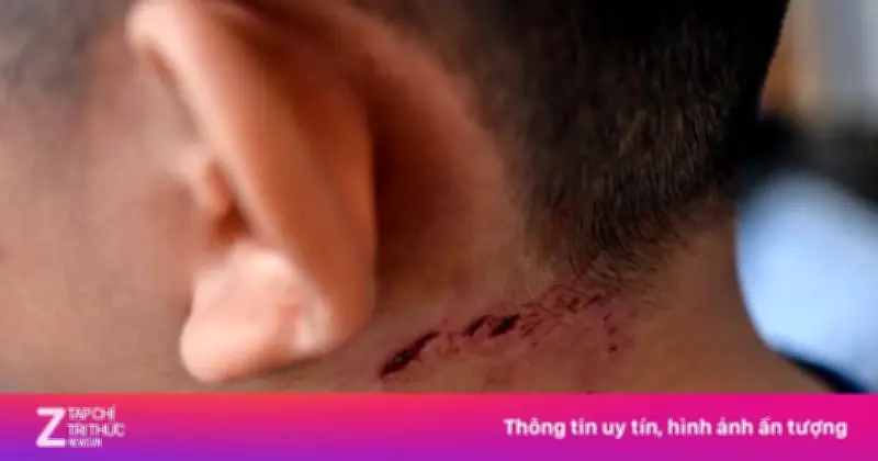 Người đàn ông Nghệ An tử vong sau 5 tháng bị chó nhà cắn vì tự chữa bằng thuốc nam