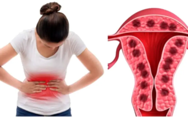 Người phụ nữ 45 tuổi suýt gặp biến chứng nặng vì mắc đái tháo đường và bệnh phụ khoa kéo dài
