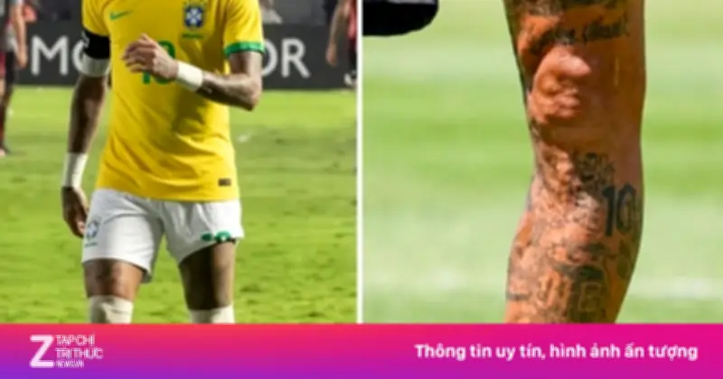 Ảnh chân trái biến dạng của Neymar hút hơn 7 triệu lượt xem