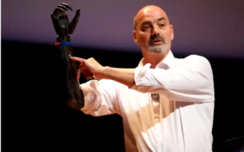 Nigel Ackland: Người đàn ông sở hữu 'cánh tay Terminator' ngoài đời thực