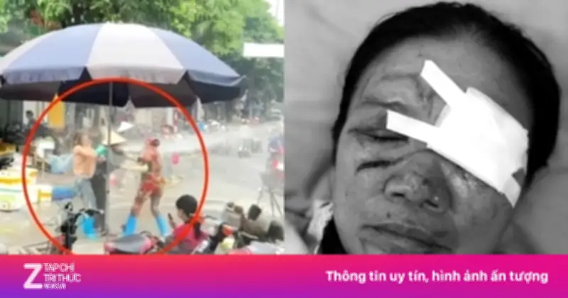Nạn nhân bị xịt nước cao áp vào mặt vẫn chưa mở được mắt