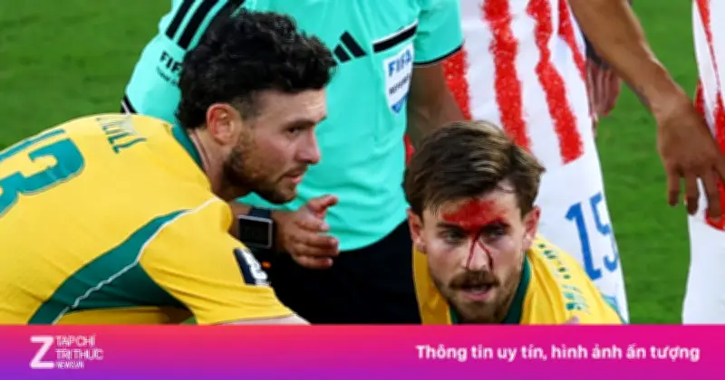 Rách mặt vẫn chiến đấu: Metcalfe khiến World Cup dậy sóng