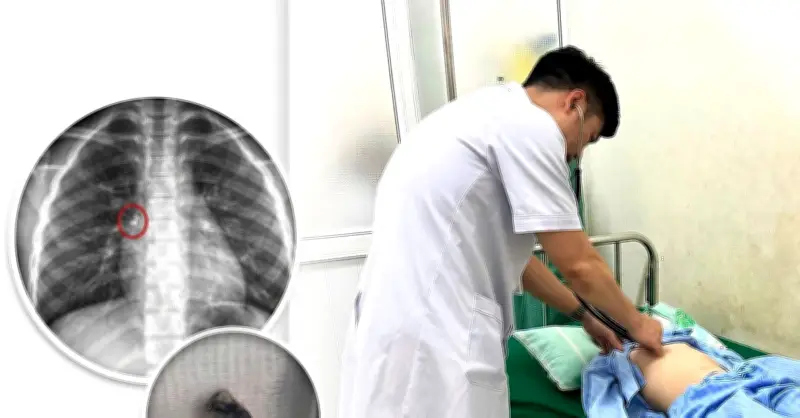 Sự cố hy hữu: Mẹ nhổ răng tại nhà, bé trai phải cấp cứu