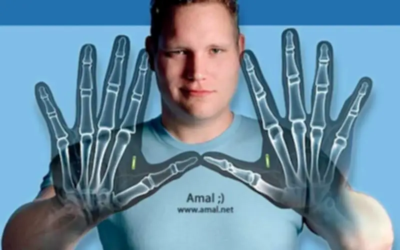 Từ người lập dị đến doanh nhân triệu đô: Hành trình biohacking của Amal Graafstra
