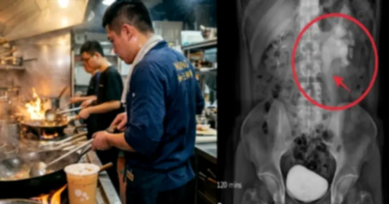 Đầu bếp 32 tuổi phù thận cấp vì uống trà sữa thay nước lọc