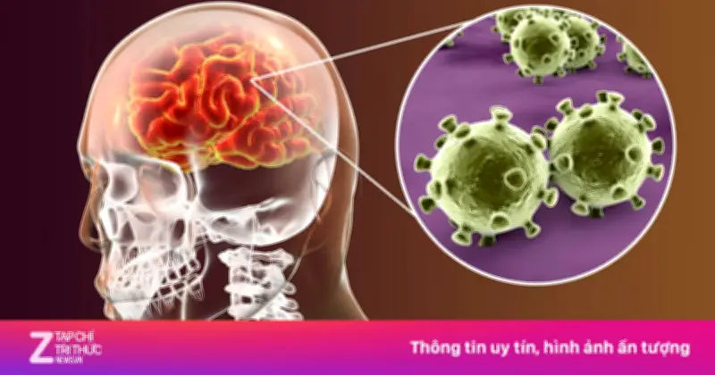 Viêm não Nhật Bản: Bệnh truyền nhiễm nguy hiểm hàng đầu ở trẻ em, phòng ngừa bằng vaccine