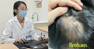 Bé gái 5 tuổi bị hói vĩnh viễn vì ôm thỏ: Cảnh báo cha mẹ
