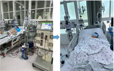 Bé trai 11 tuổi viêm cơ tim nguy kịch vì sai lầm của cha mẹ khi con sốt nhẹ