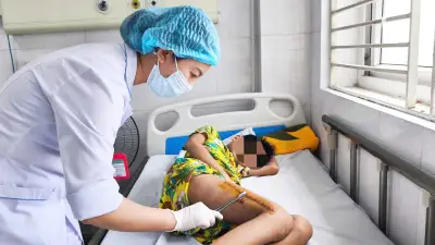 Cảnh báo từ trường hợp bệnh nhi suýt tử vong, mất chân vì vi khuẩn tụ cầu vàng