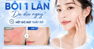 Da nhạy cảm không phải loại da, mà là dấu hiệu hàng rào bảo vệ bị tổn thương