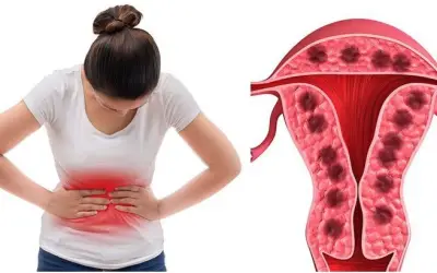Người phụ nữ 45 tuổi suýt gặp biến chứng nặng vì mắc đái tháo đường và bệnh phụ khoa kéo dài