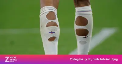 Vì sao cầu thủ World Cup 2026 mang tất thủng lỗ chỗ?