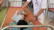 43 ca ngộ độc bánh mì ở Quảng Nam, nghi do vi khuẩn Salmonella