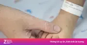 Bé gái 23 tháng tuổi nguy kịch vì tay chân miệng độ IV, suy hô hấp phải lọc máu