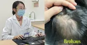 Bé gái 5 tuổi bị hói vĩnh viễn vì ôm thỏ: Cảnh báo cha mẹ