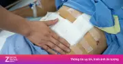 Bệnh chuyển hóa đang trẻ hóa: Người trẻ mắc gan nhiễm mỡ, tiền đái tháo đường ngày càng nhiều
