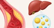 Cholesterol là gì? Phân biệt cholesterol tốt và xấu, cách kiểm soát hiệu quả
