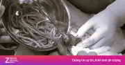 Dấu hiệu cảnh báo người lớn cần xổ giun sán kịp thời