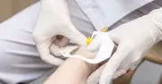 Liệu pháp miễn dịch chu phẫu tăng gấp đôi tỷ lệ đáp ứng ung thư bàng quang