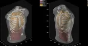 Midjourney ra mắt máy quét siêu âm toàn thân, nhanh hơn MRI gần 100 lần