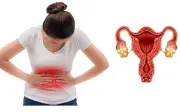 Phụ nữ 25 tuổi mắc buồng trứng đa nang vẫn sinh con khỏe mạnh nhờ phương pháp này