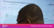 Trạm radar y tế theo dõi dịch bệnh suốt World Cup 2026