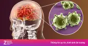 Viêm não Nhật Bản: Bệnh truyền nhiễm nguy hiểm hàng đầu ở trẻ em, phòng ngừa bằng vaccine