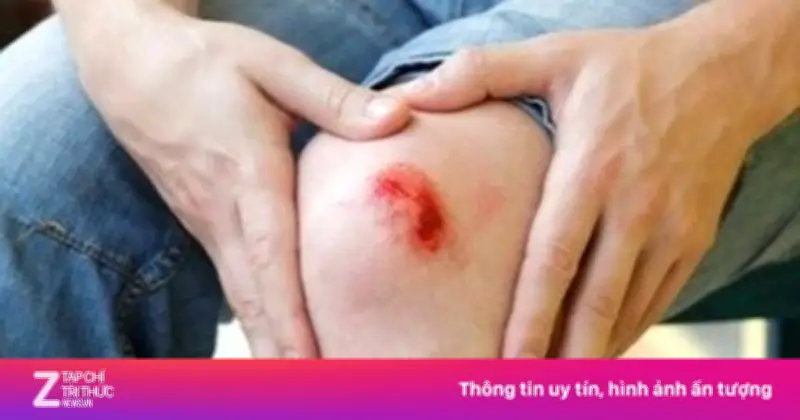 Dấu hiệu cơ thể đang thiếu kẽm trầm trọng và cách nhận biết