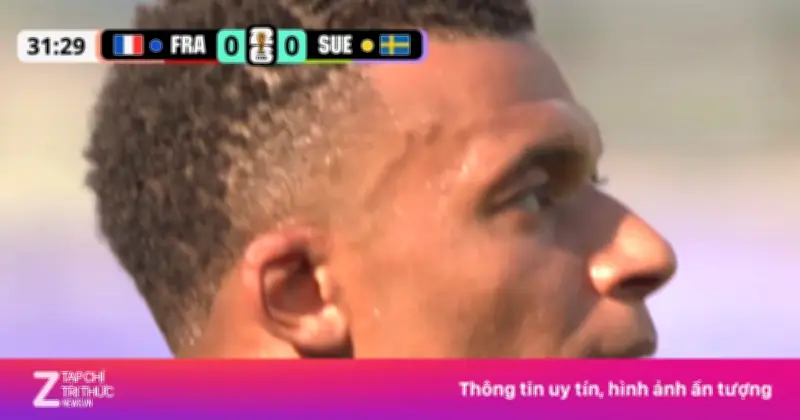 Nốt sần trên mặt Mbappe gây bão mạng xã hội với 60 triệu view