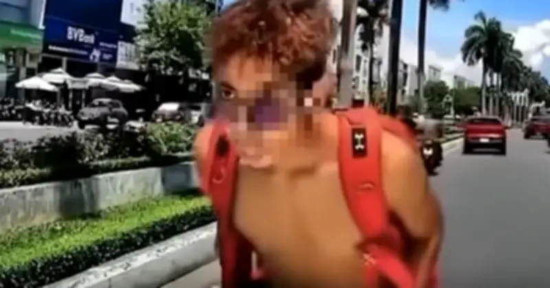 Thanh niên trượt ván giữa làn ô tô ở Đà Nẵng âm tính ma túy, đang điều trị tâm thần