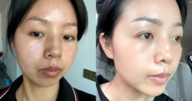 Top 6 serum mờ nám hiệu quả nhất 2026: Từ chân sâu đến sạm màu