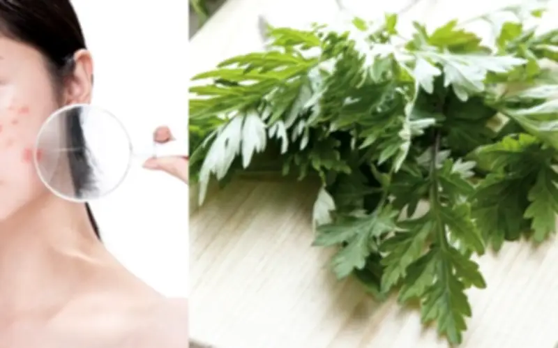 Trị mụn bằng ngải cứu hiệu quả, an toàn, không để lại vết thâm