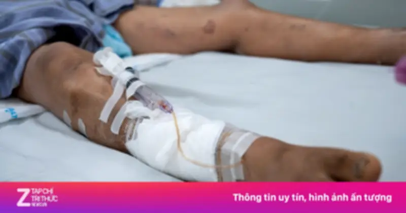 Vết xước nhỏ do cành rào gây uốn ván nguy kịch ở người đàn ông 65 tuổi